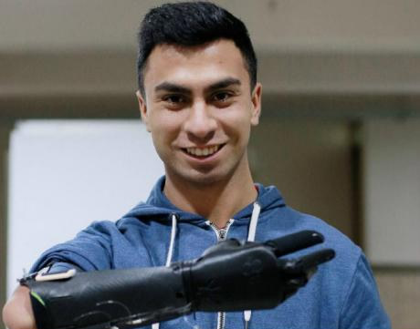 Estudiantes de la USACH diseñaron y fabricaron modernas prótesis ortopédicas